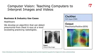 CheXNet: a 121-layer network reading chest X-rays