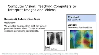 CheXNet: detecting pneumonia from chest X-rays at the level of radiologists